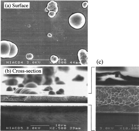 Sem Images Of An Electroless Ni P Layer Directly Plated On An Ms