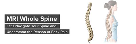 MRI Whole Spine- Navigate Your Spine and Know the Reason of Back Pain