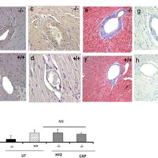 Immunohistochemical Analysis Of AT1a And NF B P65 Subunits Protein