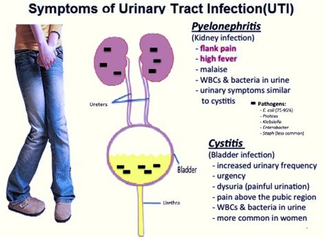 Urinary Tract Infection Uti Treatment Using Homeopathy With Excellent