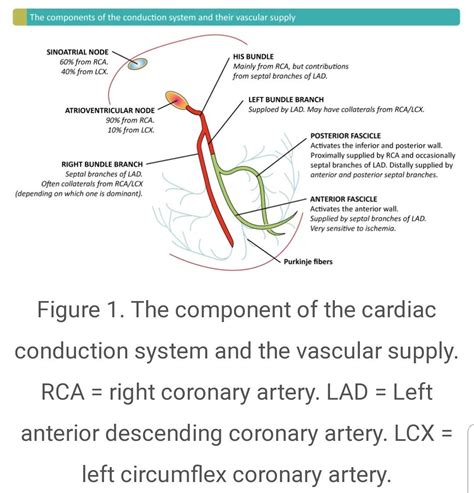 Supraventricular And Intraventricular Conduction Defects In Myocardial