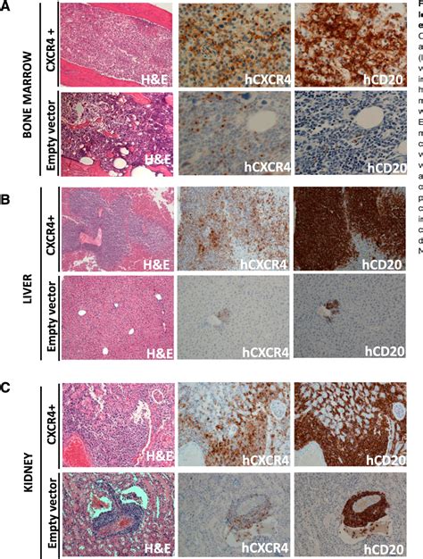 Figure From Lymphoid Neoplasia C G Cxcr Acts As A Driver