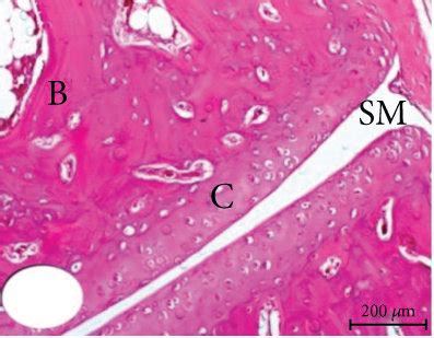 Photomicrographs X Of He Stained Sections Showing The Effect Of