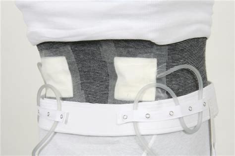 Buy The Patent Nephrostomy Tube And Bag Support Belt Patent For Sale