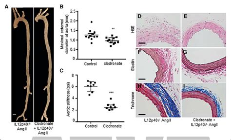 Depletion Of Macrophages In Il12p40 −− Interleukin 12 P40 Mice Download Scientific Diagram