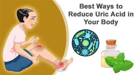 Best Ways To Reduce Uric Acid In Your Body Youtube