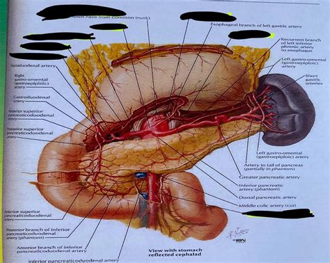 Arteries Of Stomach Duodenum Pancreas And Spleen Plate Diagram