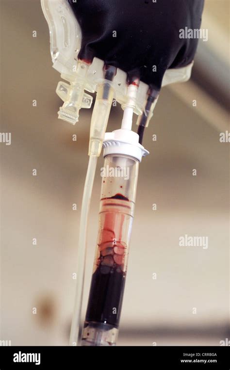 Blood Bag Being Used In Blood Transfusion Stock Photo Alamy