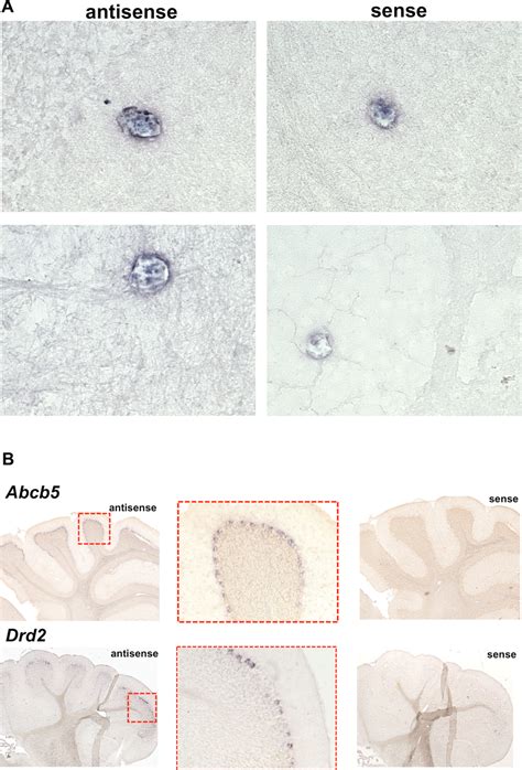 Abcb5 MRNA Expression In Mouse Brain In Situ Hybridization Was