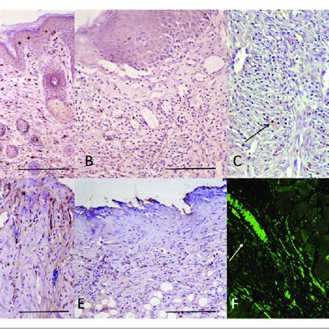 Immunohistochemical Analysis Of The Inflammatory Infiltrate Skin Download Scientific Diagram