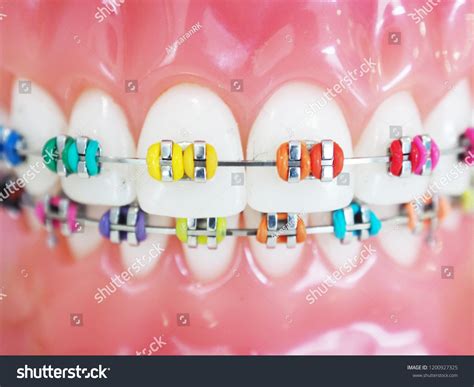 16,003 Braces colors Images, Stock Photos & Vectors | Shutterstock