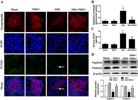 P Drp Dependent Mitochondrial Fission Mediates Aldosterone Induced