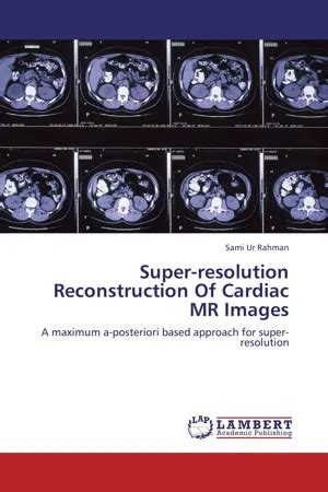 Pdf Super Resolution Reconstruction Of Cardiac Mr Images By Sami Ur