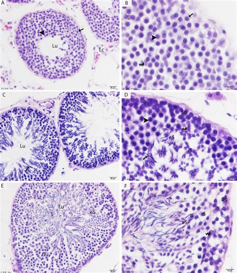 Novel Cellular Evidence Of Lipophagy Within The Sertoli Cells During