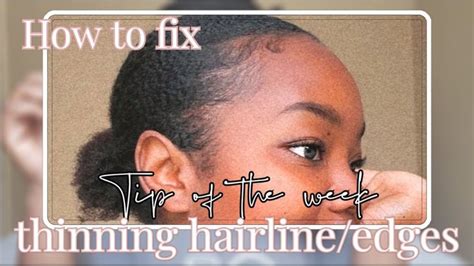 Hair Growth Tip#7 Grow back your edges or hairline |[My journey to waist length hair]