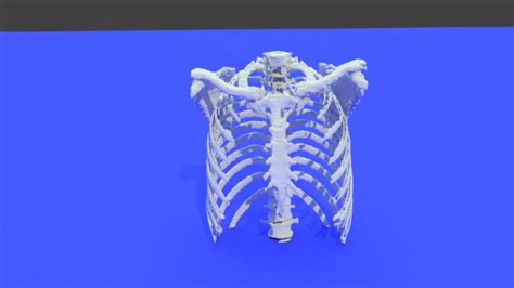 Easily Convert Medical Scans To 3d Printable Models Dicom To Stl