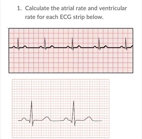 Solved 1 Calculate The Atrial Rate And Ventricular Rate For