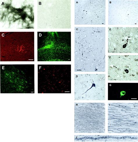 Formation Of Neurofibrillary Tangles In P301l Tau Transgenic Mice