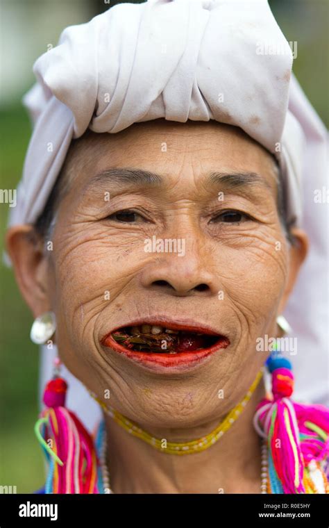 Betel Nut Teeth Hi Res Stock Photography And Images Alamy