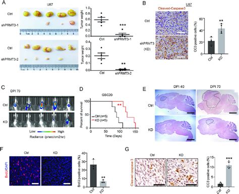 PRMT3 Is Required For The GBM Tumor Formation And Progression In Vivo