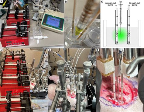 Defining The Spatial Resolution Of Analyte Recovery During