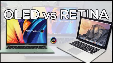 Ecran Oled Vs Retina Hotsell