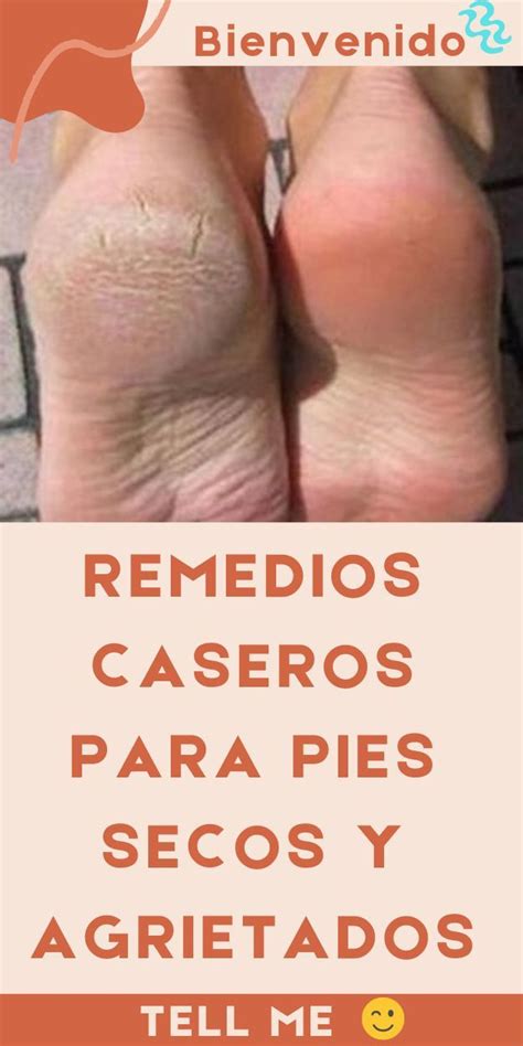 Remedios Caseros Para Pies Secos Y Agrietados Remedio Para Pies