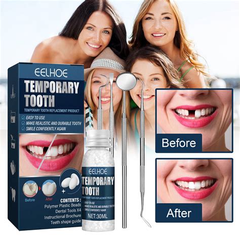 Gofj 1 Set Teeth Gel Repair Denture Moldable Long Lasting Quick Melt