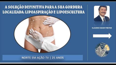 A Solu O Definitiva Para A Sua Gordura Localizada Lipoaspira O E