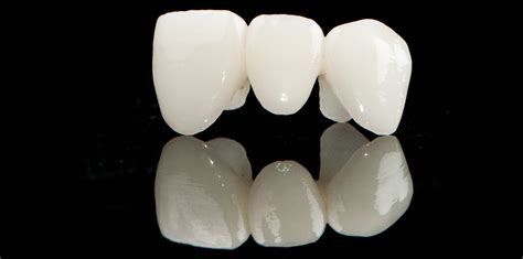 Products NatZRal Super Translucent Zirconia Iverson Dental Labs