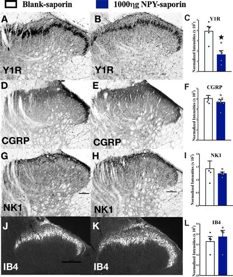 NPY Saporin Lesion Selectively Reduces Y1R Ir In The Dorsal Horn Y1R