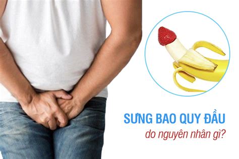 Sưng bao quy đầu do nguyên nhân gì