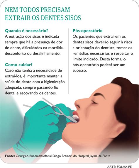 Dentes Do Siso Realmente Necess Rio Retir Los Vida Plena Folha Pe