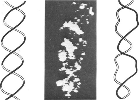 High Resolution Electron Micrograph Of Viral Dna And Two Schematic