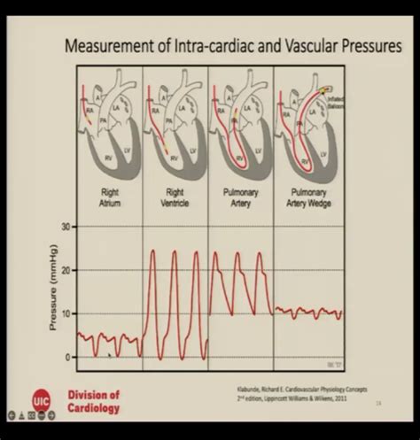 Uicom B4w4 Valvular Disease Flashcards Quizlet