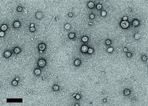 Vesicles Microscope