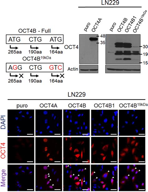 Subcellular Localization Of Oct Isoforms In Human Glioblastoma Cells