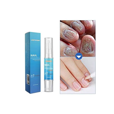 Buy Sweetds Anti Fungal Nail Solution Onychomycosis Paronychia