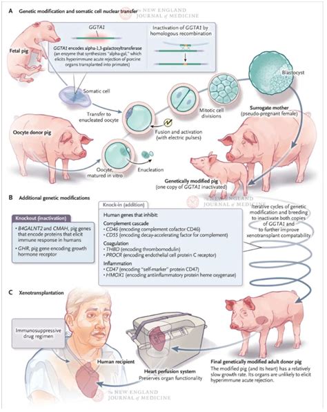 Nejm发表猪心移植病例，非典型排斥迷雾重重 头条 呼吸界