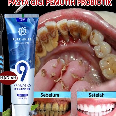 Jual KP8 Pasta Gigi Pemutih Probiotik Soda Kue Memutihkan Gigi