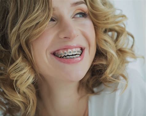 Baldwin Park Dental Center Braces For Adults