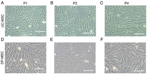 Morphological Observations Of Uc Mscs And Dp Mscs In Different Download Scientific Diagram