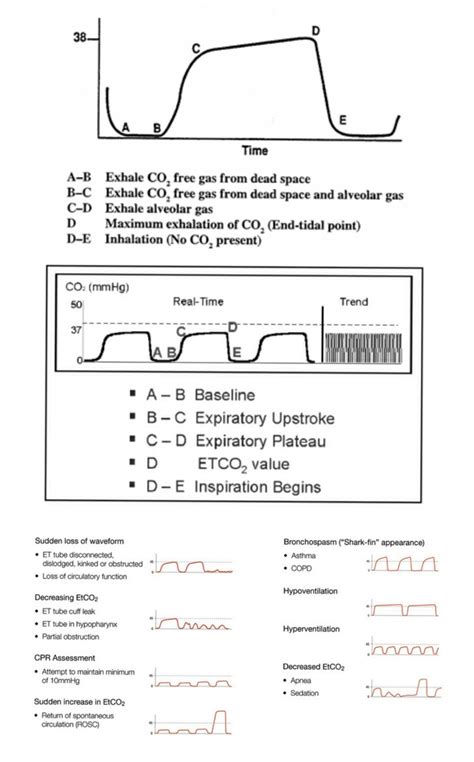 end tidal co2 waveforms - Kori Olivas