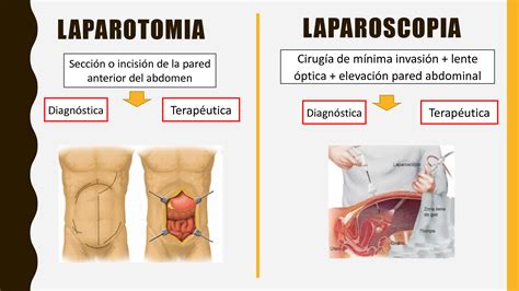 SOLUTION Laparotomia Y Laparoscopia Studypool