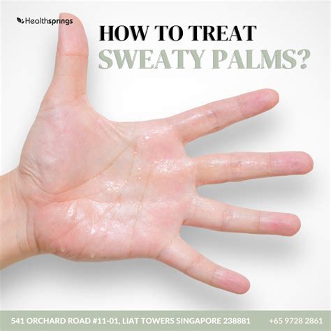 How To Treat Sweaty Palms