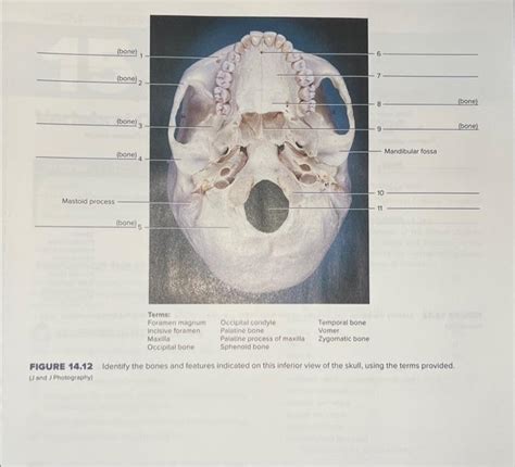 Solved Figure Identify The Bones And Features Chegg