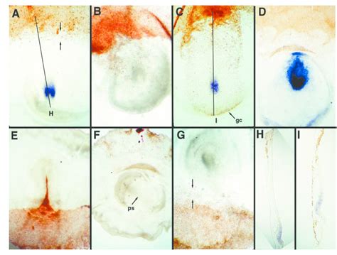 Examples Of The Distribution Of Quail Cells In Whole Mounts And