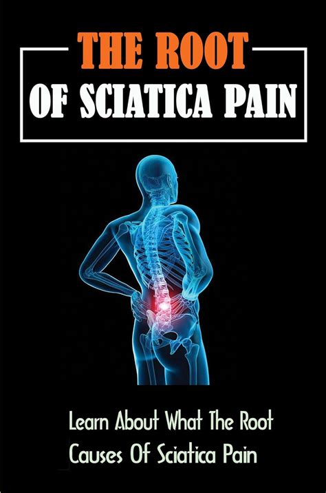 The Root Of Sciatica Pain Learn About What The Root Causes Of Sciatica