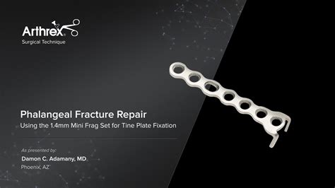 Arthrex Fracture Management