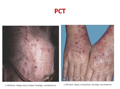 Cutaneous Manifestation Of Systemic Disease By Dr Eman